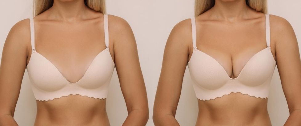 Breast Aesthetics: All That You Need to Know