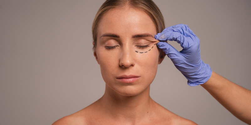 Blepharoplasty: All That You Need to Know