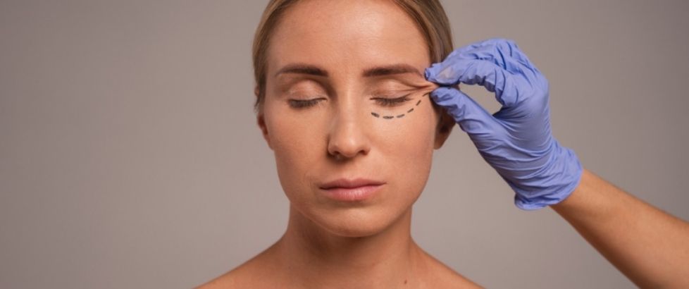 Blepharoplasty: All That You Need to Know