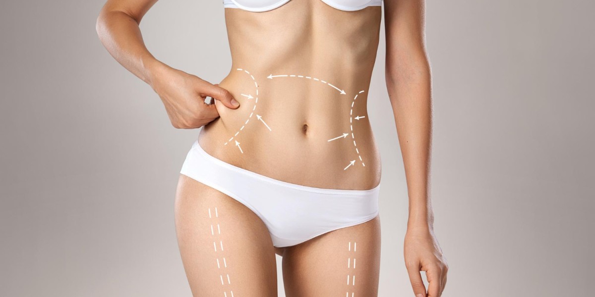 Unveiling the Advantages of Liposuction: Enhancing Your Body Contourin