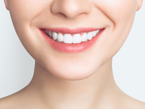 Dental Veneers