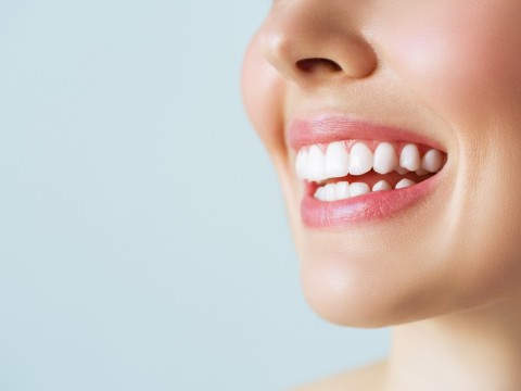 Dental Veneers