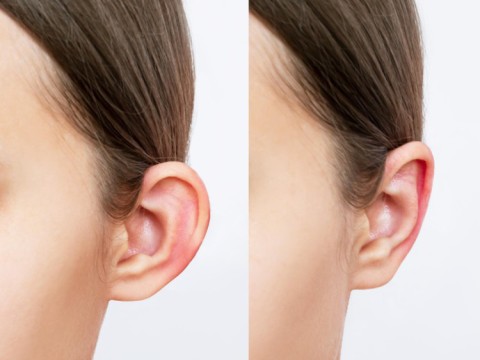 Aesthetic Ear Surgery (Otoplasty)