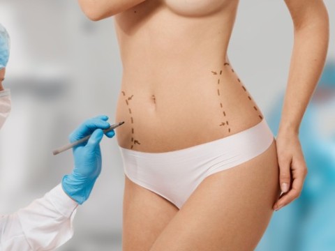 Mommy Makeover (mit Implantat)