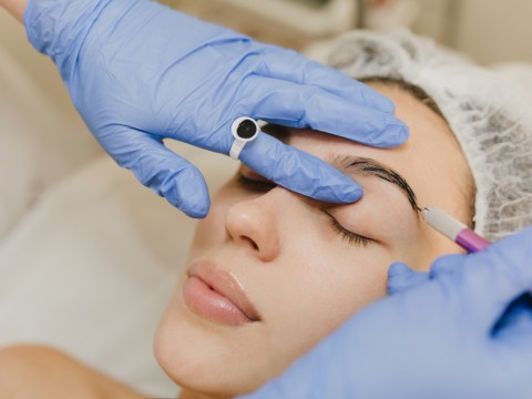 Eyebrow Transplantation