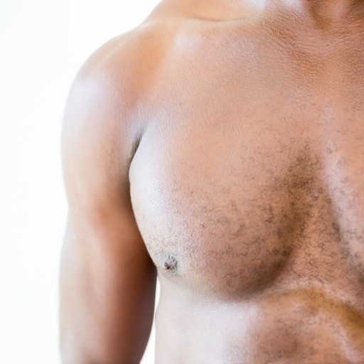 Уменьшение груди у мужчин (гинекомастия)