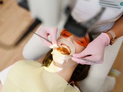 Root Canal Treatment