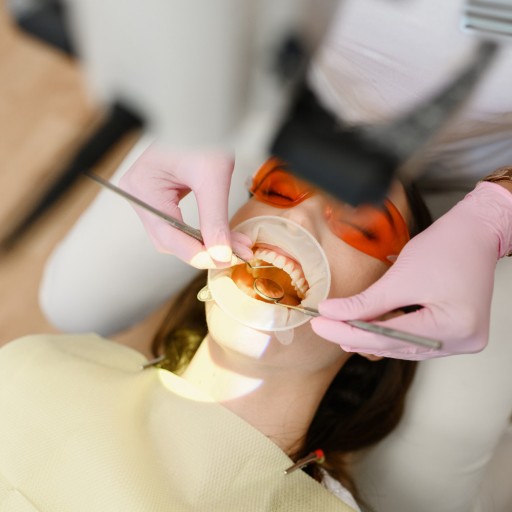 Root Canal Treatment