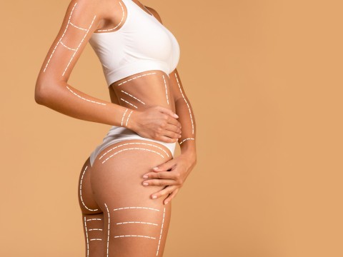 Yağ Aldırma (Liposuction)