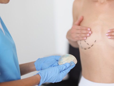 Breast Lift Surgery