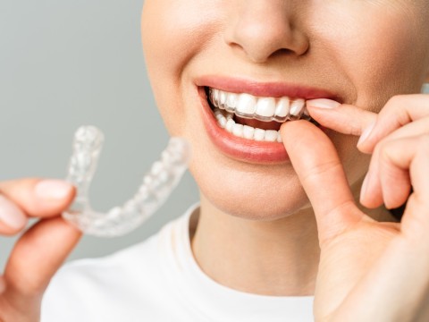 Orthodontic Treatment