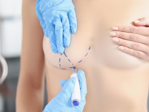 Breast Reconstruction Surgery