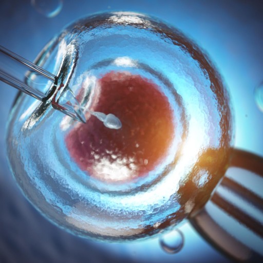 IVF (In Vitro Fertilization)