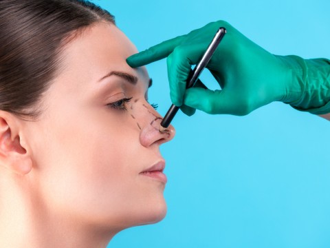 Rhinoplastik