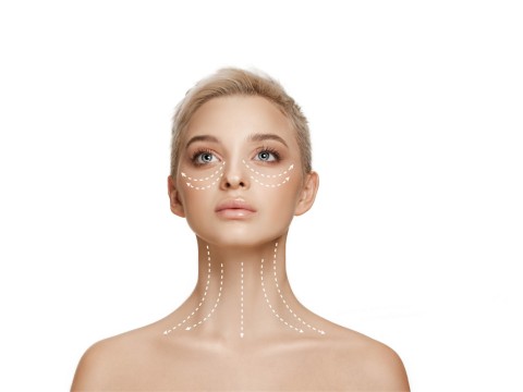 Face and Neck Lift