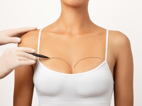 Breast Augmentation & Lift