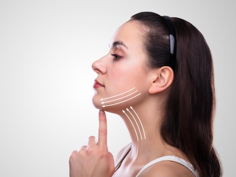 Chin Implant