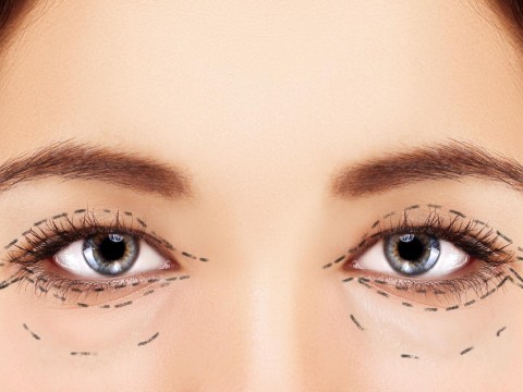 Blepharoplastik des oberen und unteren Augenlids