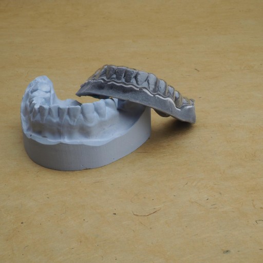 Temporary Prosthesis (Single Jaw)