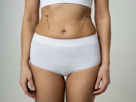 Abdominoplasty | Tummy Tuck